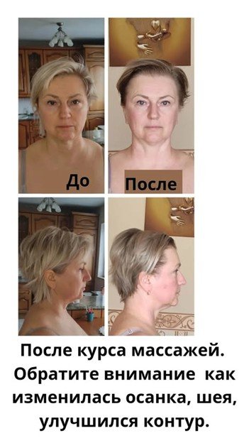 Pirms/pēc sejas masāža